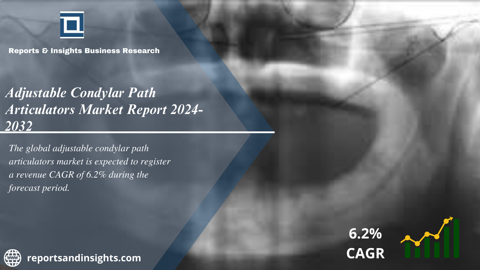 Adjustable Condylar Path Articulators Market Size, Share, Trends, Analysis and Research Report 2024 to 2032